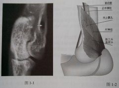 猫常识性骨折特点